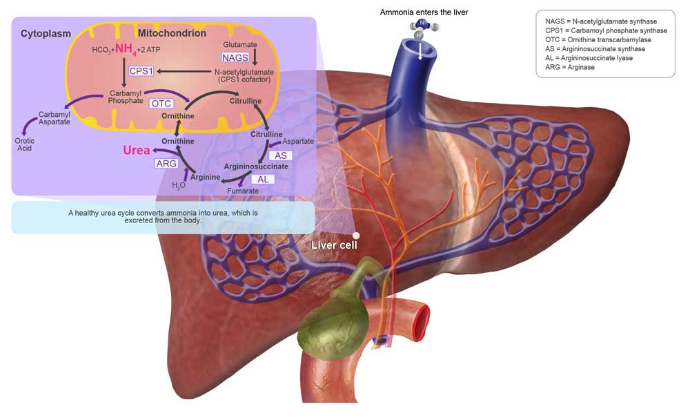 Urea Cycle Disorders Ucds Acer Therapeutics